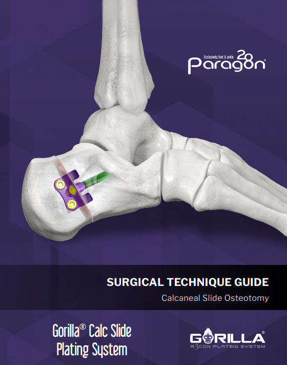 gorilla calc slide plating