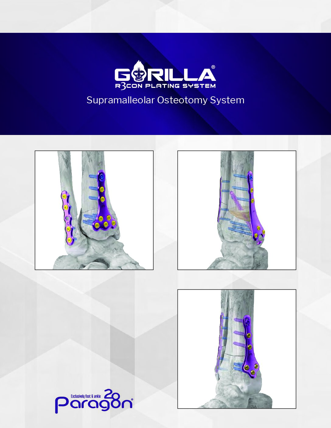 https://paragon.fru.qa/app/uploads/2023/06/GSMP-BRO-0001-RevA-Gorilla-SMO-Brochure-pdf.jpg