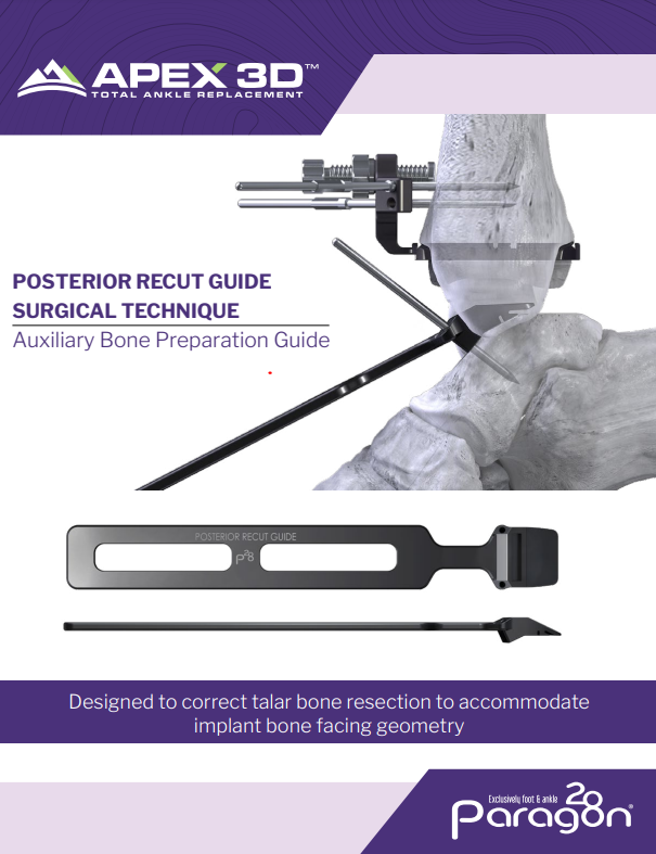 https://paragon.fru.qa/app/uploads/2023/07/Apex-STG-POSTERIOR-RECUT-GUIDE-Auxiliary-Bone-Preparation-Guide.png