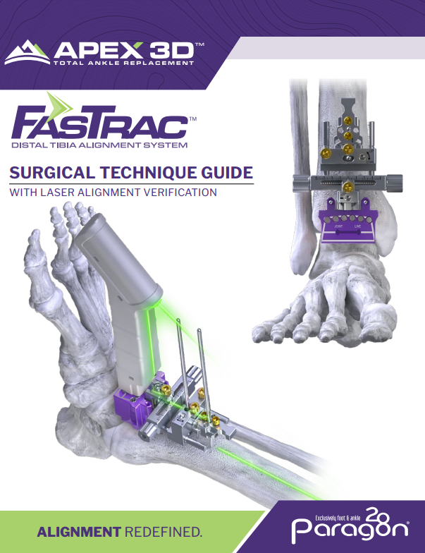 fastrack stg w laser alignment