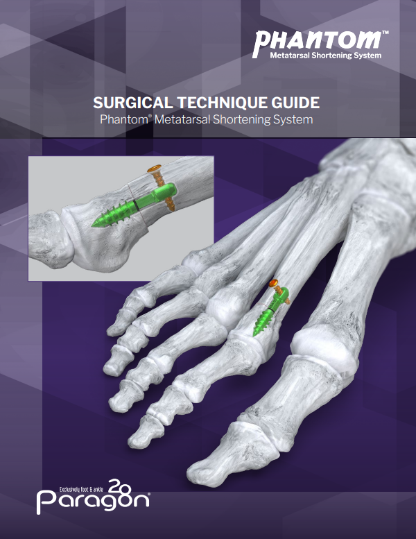 phantom metatarsal shortening stg