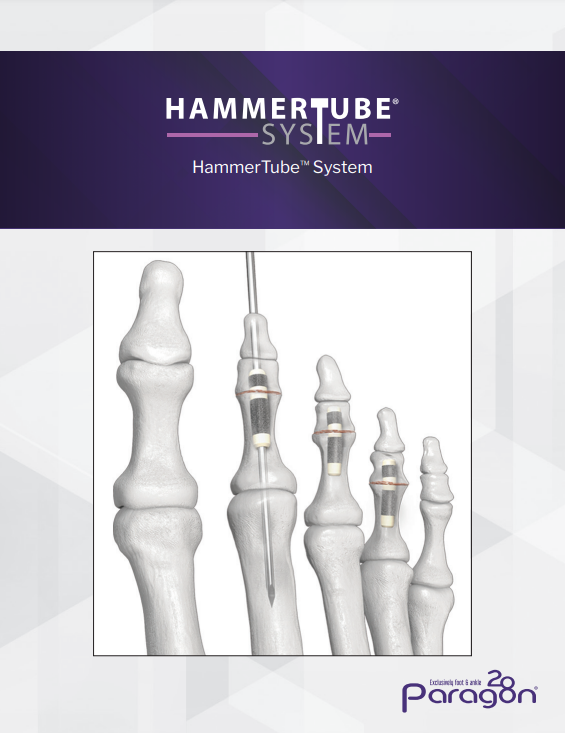 hammertube brochure
