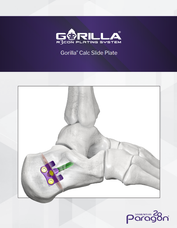 gorilla calc slide