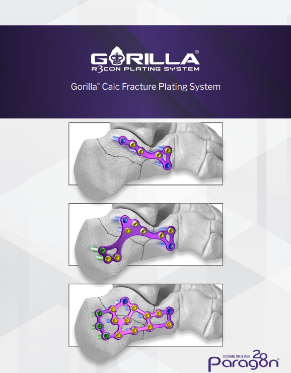 gorilla calc