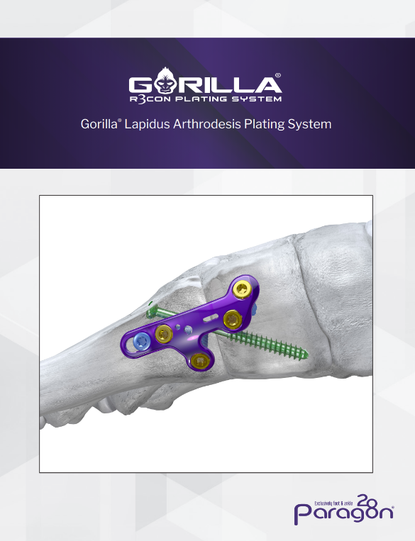 gorilla lapidus