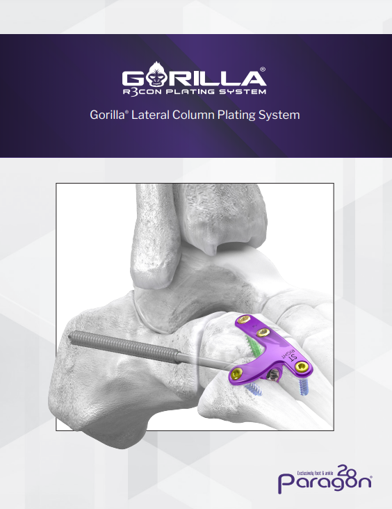 gorilla lateral column