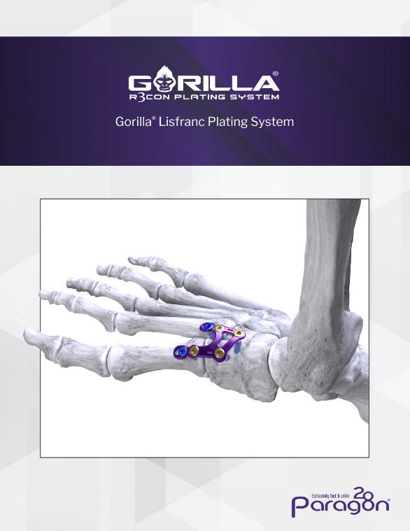 lisfranc brochure