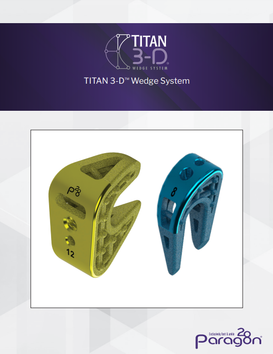 titan brochure