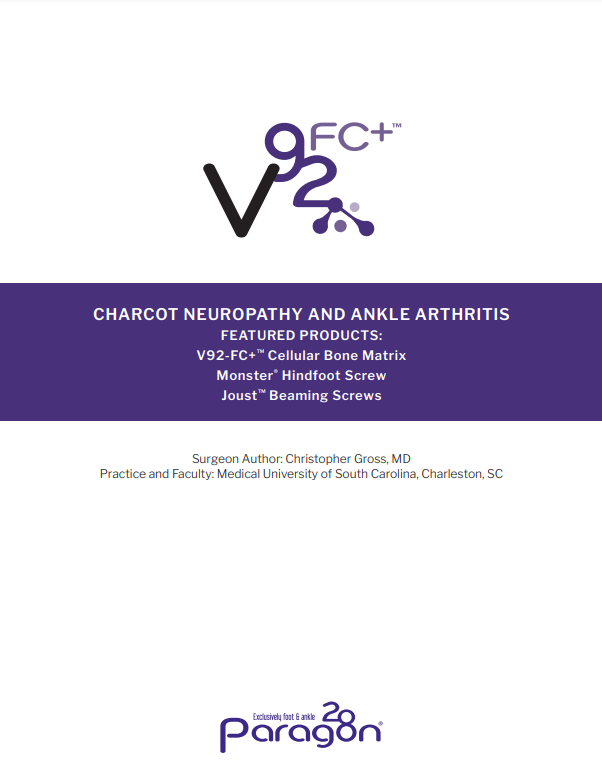 CHARCOT NEUROPATHY AND ANKLE ARTHRITIS