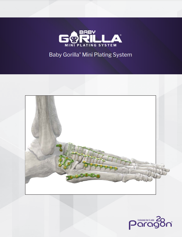 baby gorilla brochure