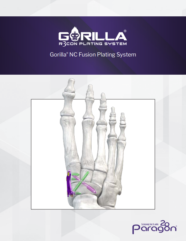 gorilla nc fusion
