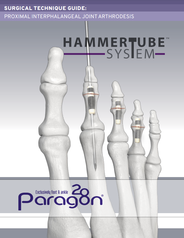hammertube stg