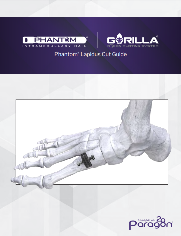 phantom lapidus cut guide