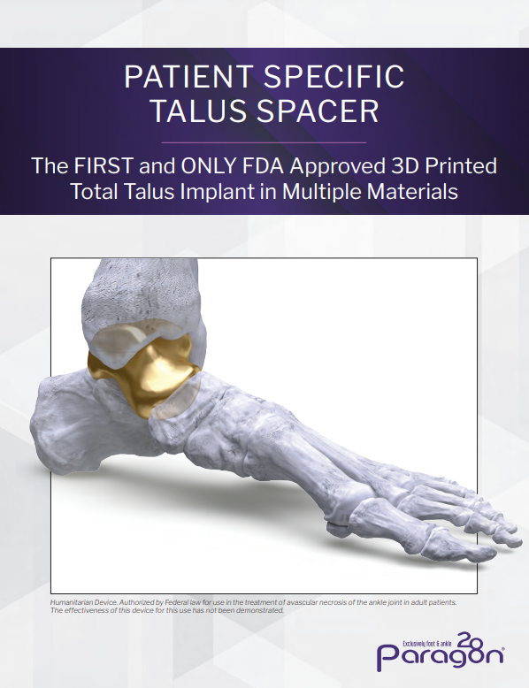 talus spacer brochure