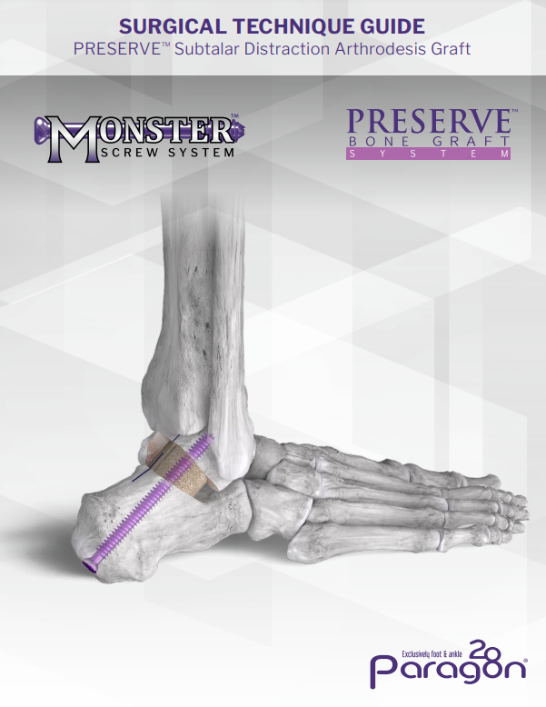 preserve subtalar distraction arthrodesis