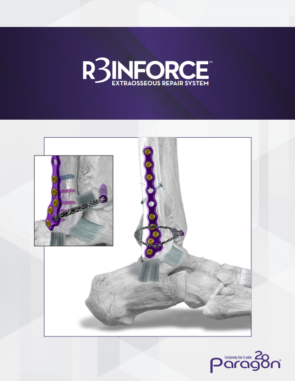r3incforce