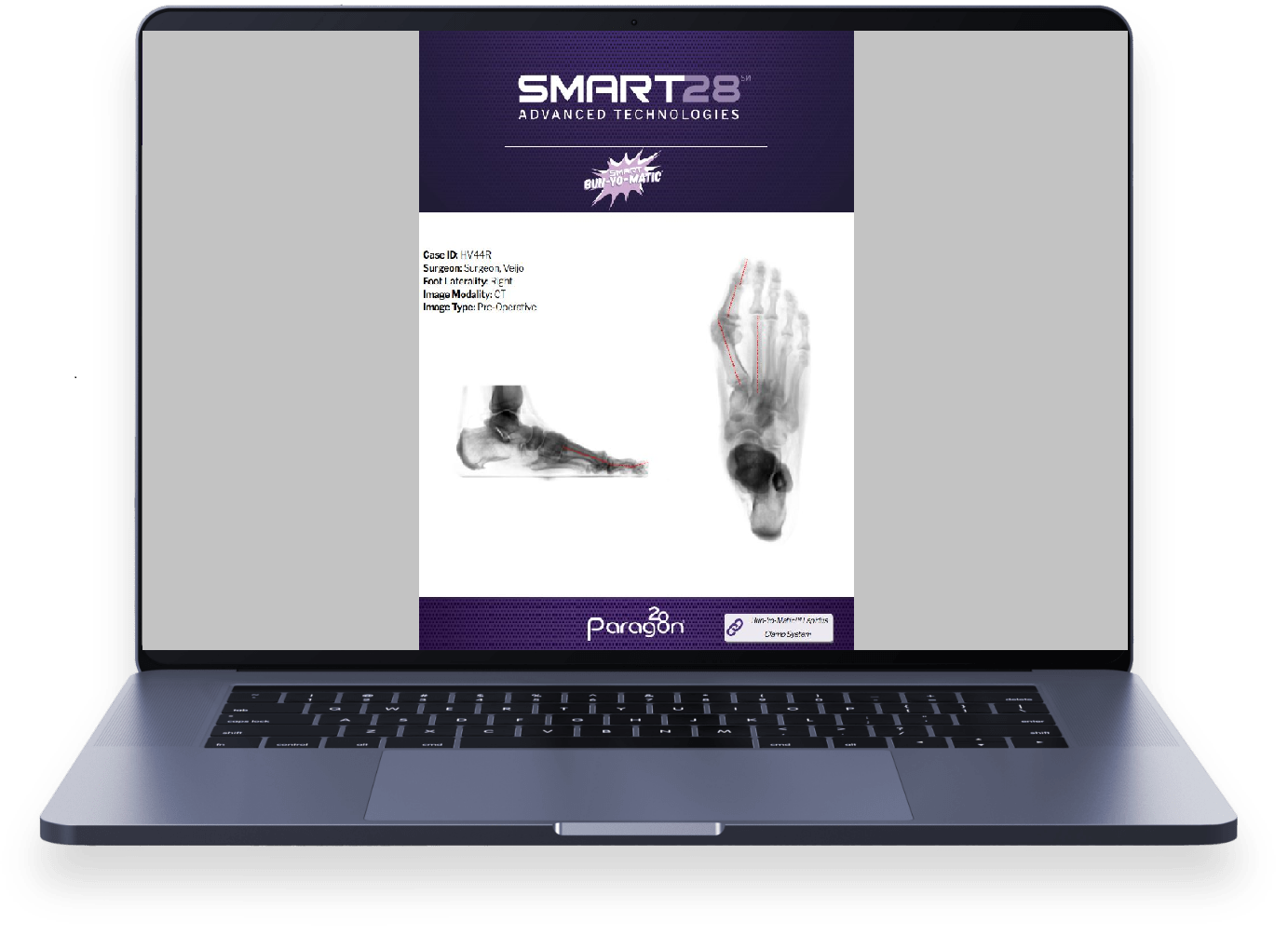 https://paragon.fru.qa/app/uploads/2024/07/smart28-laptop-showcase-min-1-1.png