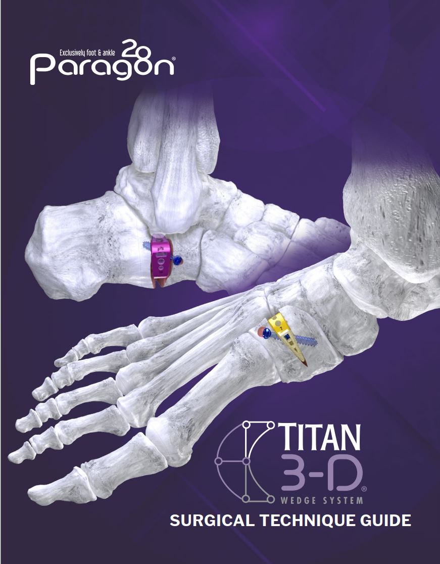 https://paragon.fru.qa/app/uploads/2024/07/ustitanwedge.jpg