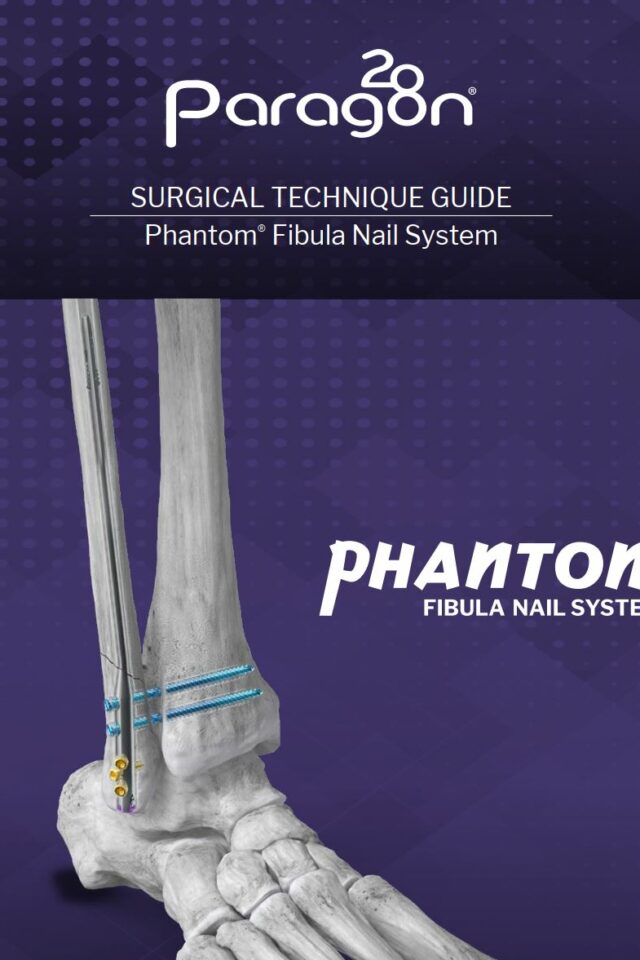 https://paragon.fru.qa/app/uploads/2024/09/fibula-stg-640x960.jpg