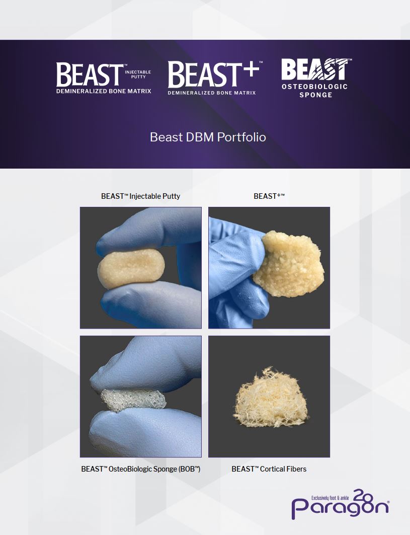 https://paragon.fru.qa/app/uploads/2024/11/beast-dbm.jpg