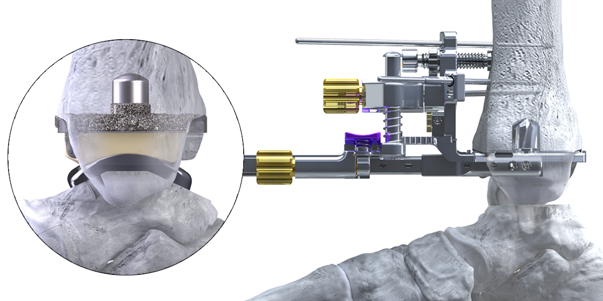https://paragon.fru.qa/app/uploads/2024/12/Website_HeroShot_Apex3D-S.png