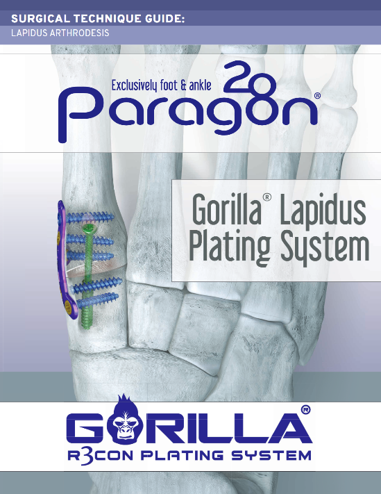 https://paragon.fru.qa/app/uploads/2025/03/Gorilla-Lapidus-Plating_Rev-B.png
