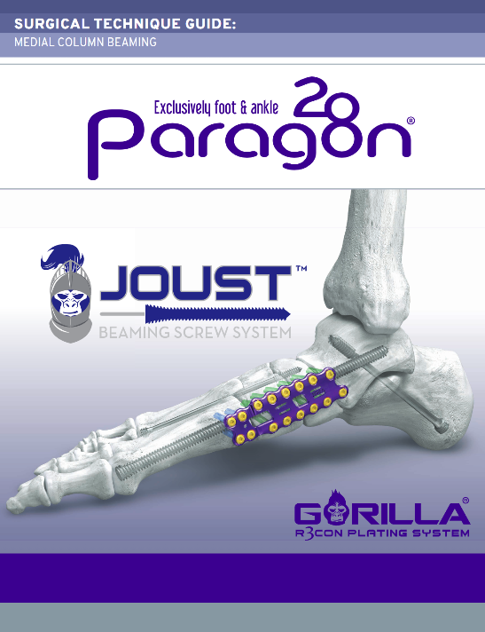 https://paragon.fru.qa/app/uploads/2025/03/JOUST-Beaming-Screw-Sysstem_Rev-E.png