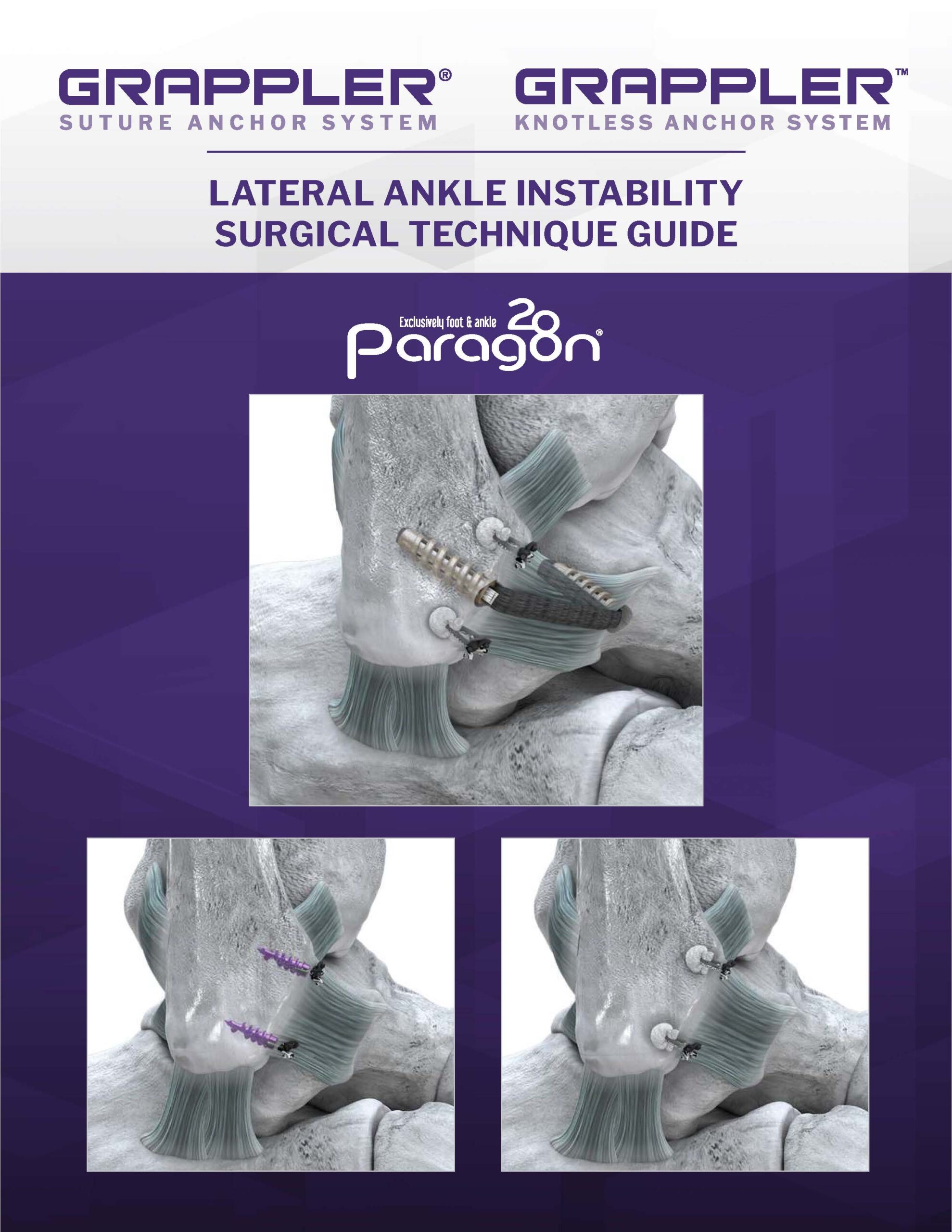 https://paragon.fru.qa/app/uploads/2025/06/P44-STG-0001-GSAS-Brostrom-Technique-STG-RevD_Cover-Image-6-scaled.jpg