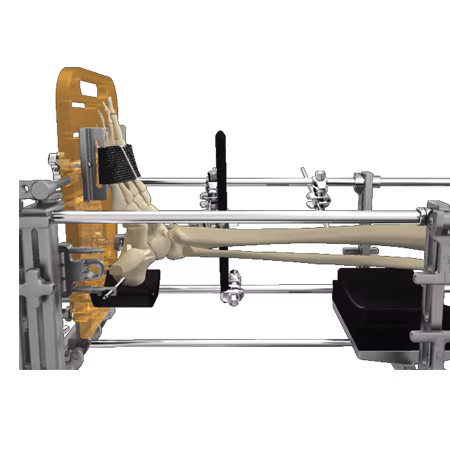 https://paragon.fru.qa/app/uploads/2025/06/tmankleframe1.avif