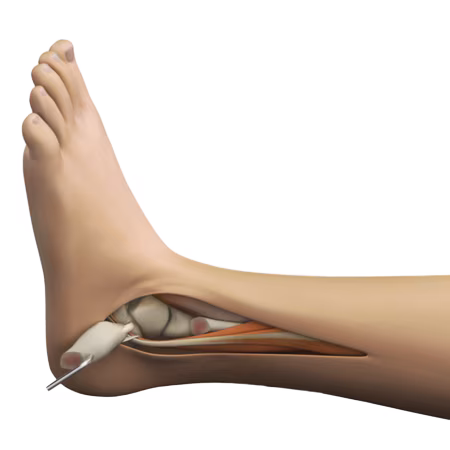 https://paragon.fru.qa/app/uploads/2025/06/tmankleillustration.avif