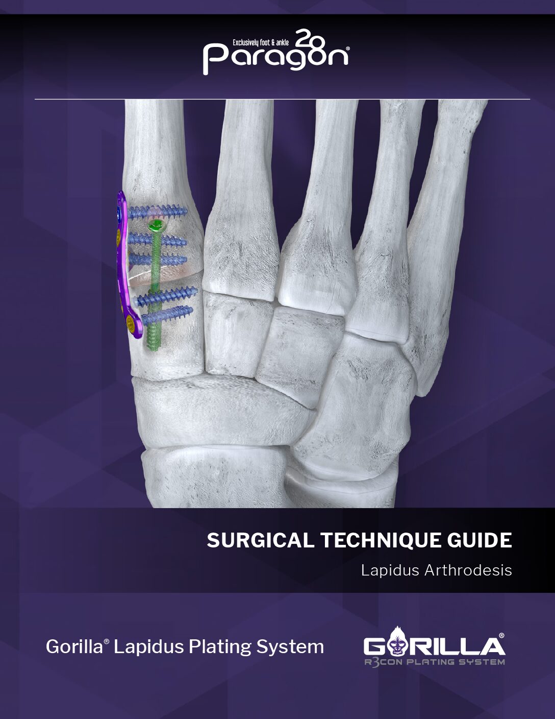 https://paragon.fru.qa/app/uploads/2025/07/P51-STG-0003-RevG_Gorilla_Lapidus_STG_US-pdf-1.jpg