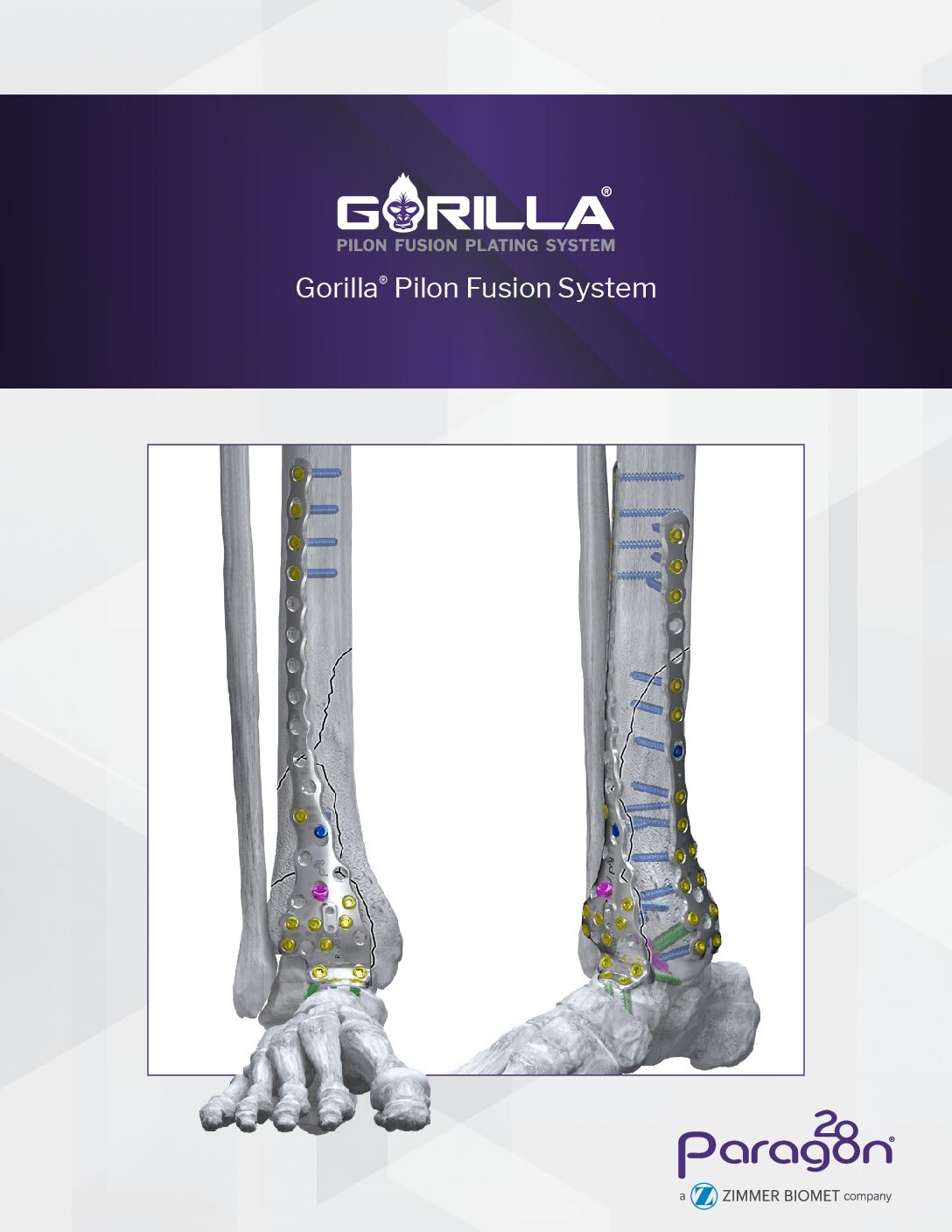 https://paragon.fru.qa/app/uploads/2025/08/GPF-BRO-01-RevA_GorillaPilon_Brochure418911614797-pdf.jpg