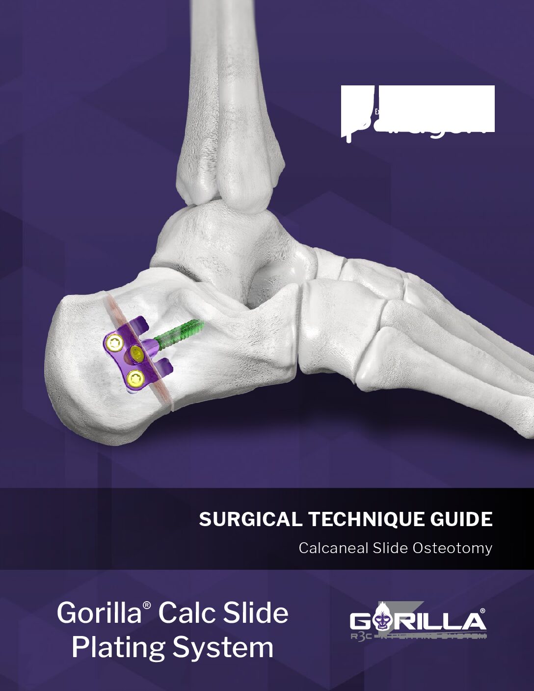 https://paragon.fru.qa/app/uploads/2025/08/P51-STG-0004-RevF_Gorilla-Calc-Slide-Plate-STG-US-pdf.jpg