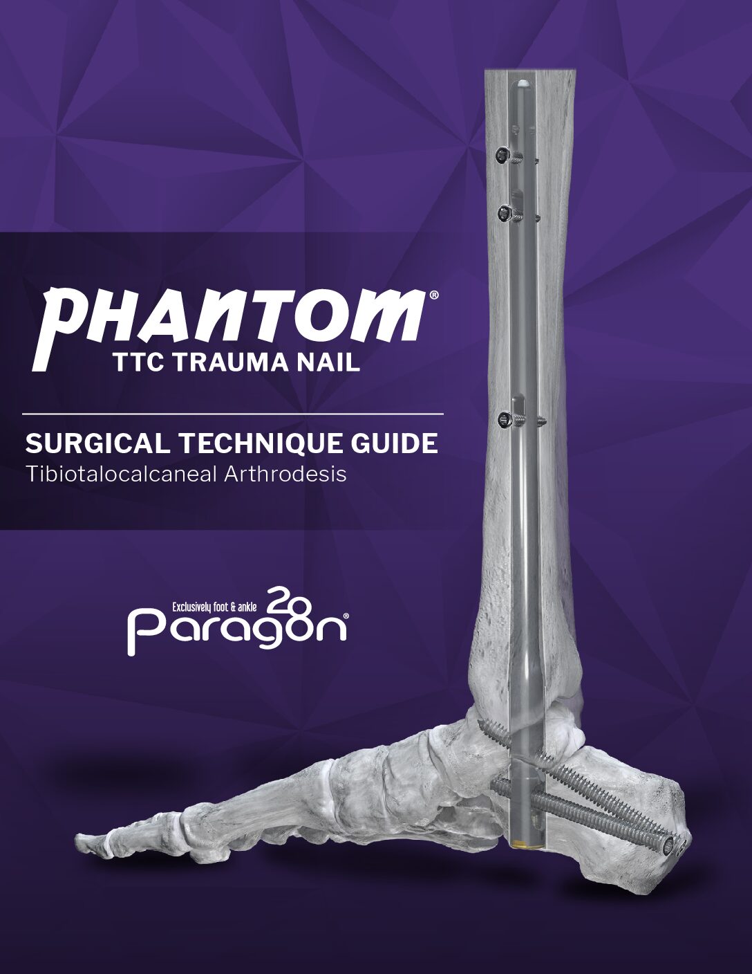 https://paragon.fru.qa/app/uploads/2025/09/P31-STG-0004-TTC-Trauma-Nail-STG-RevA-US-pdf.jpg