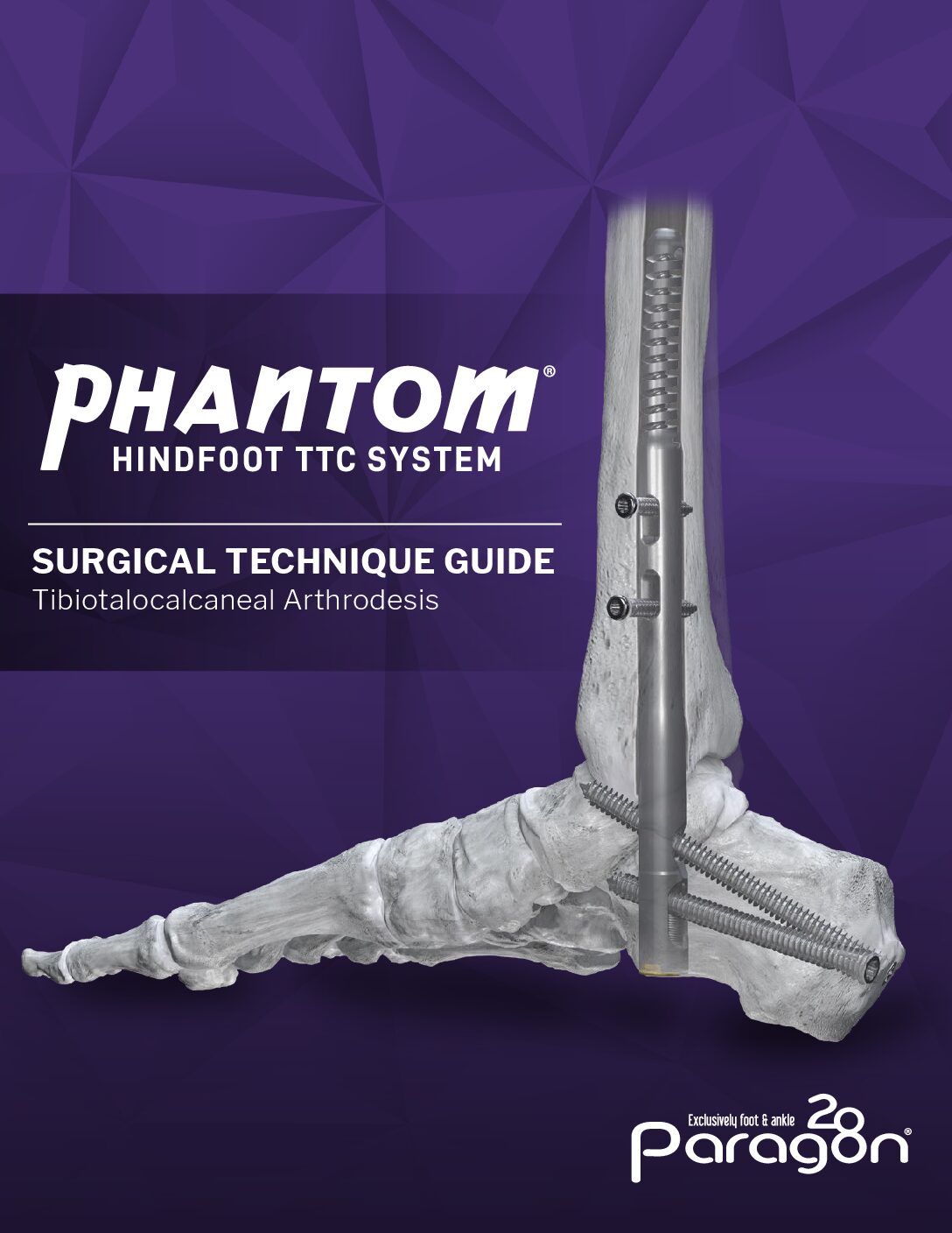 https://paragon.fru.qa/app/uploads/2025/09/P31-STG-1001-RevF_PhantomTTCNail_STG_OUS-pdf.jpg