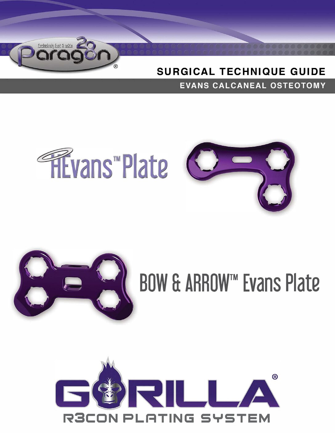 https://paragon.fru.qa/app/uploads/2025/09/P51-STG-0005-RevD_Gorilla-Evans-Procedure-STG-US-pdf.jpg