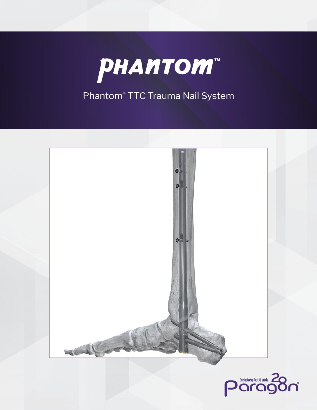 https://paragon.fru.qa/app/uploads/2025/09/PhantomTraumaNailBrochure-pdf.jpg