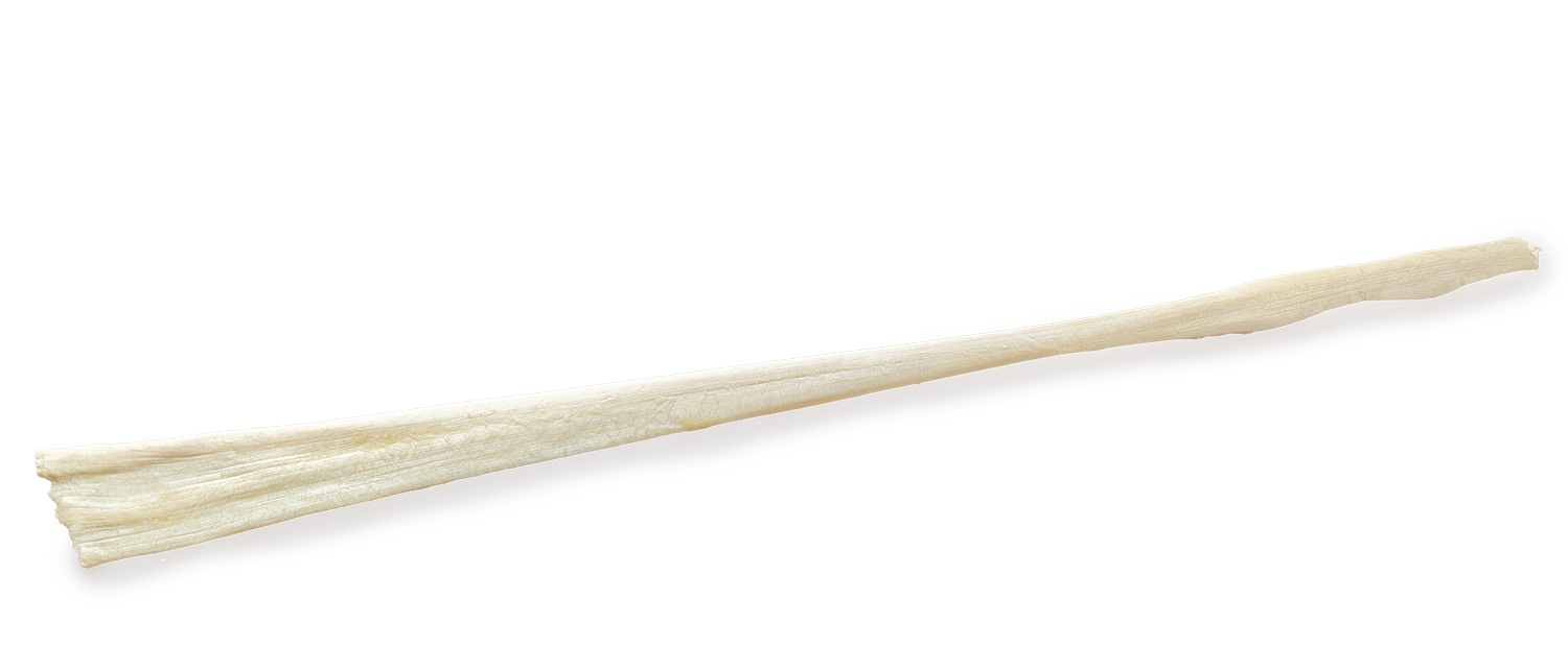 https://paragon.fru.qa/app/uploads/2025/10/Peroneus-Tendon.jpg