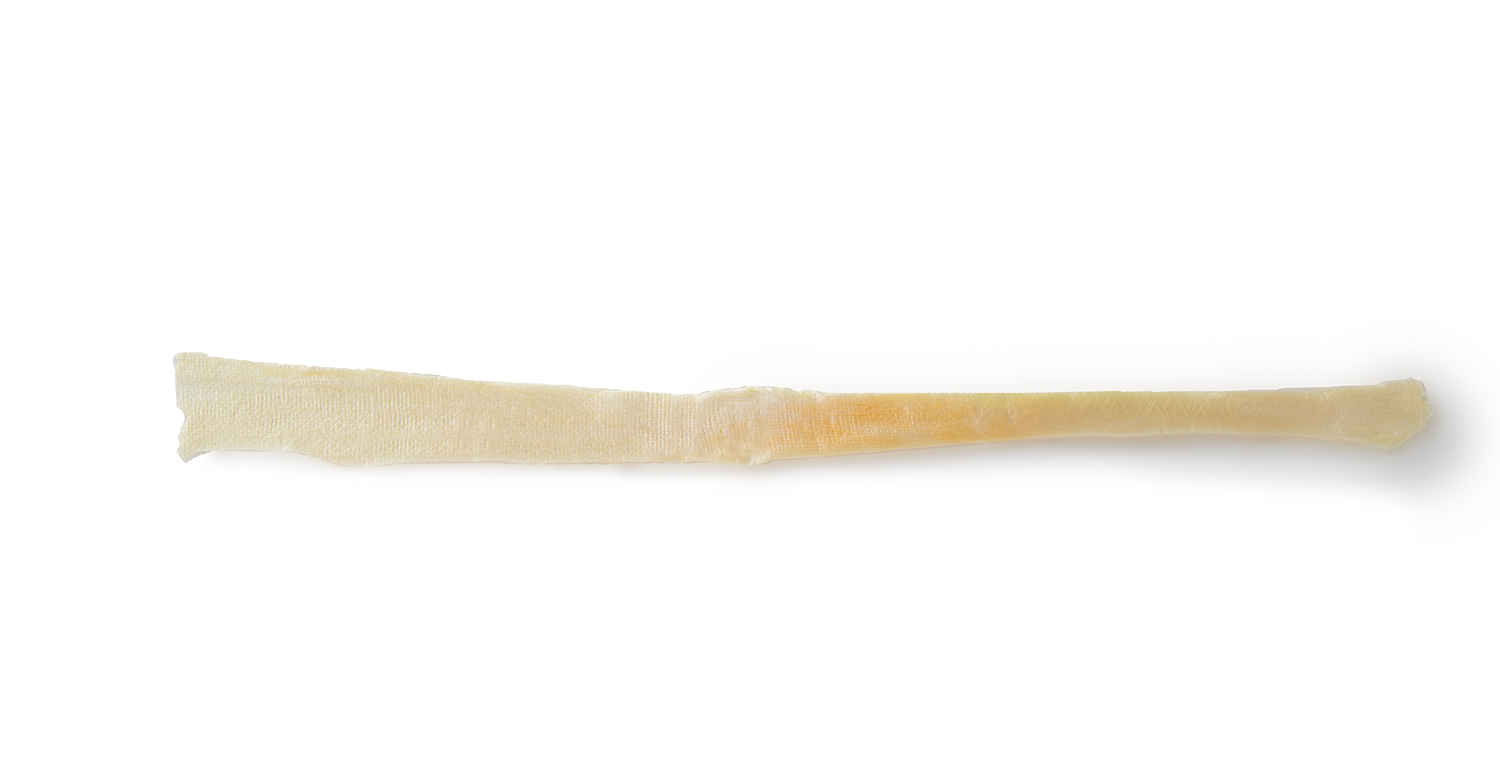 https://paragon.fru.qa/app/uploads/2025/10/Tibialis-Tendon-Anterior.png