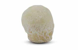 https://paragon.fru.qa/app/uploads/2025/10/femoral-head.png