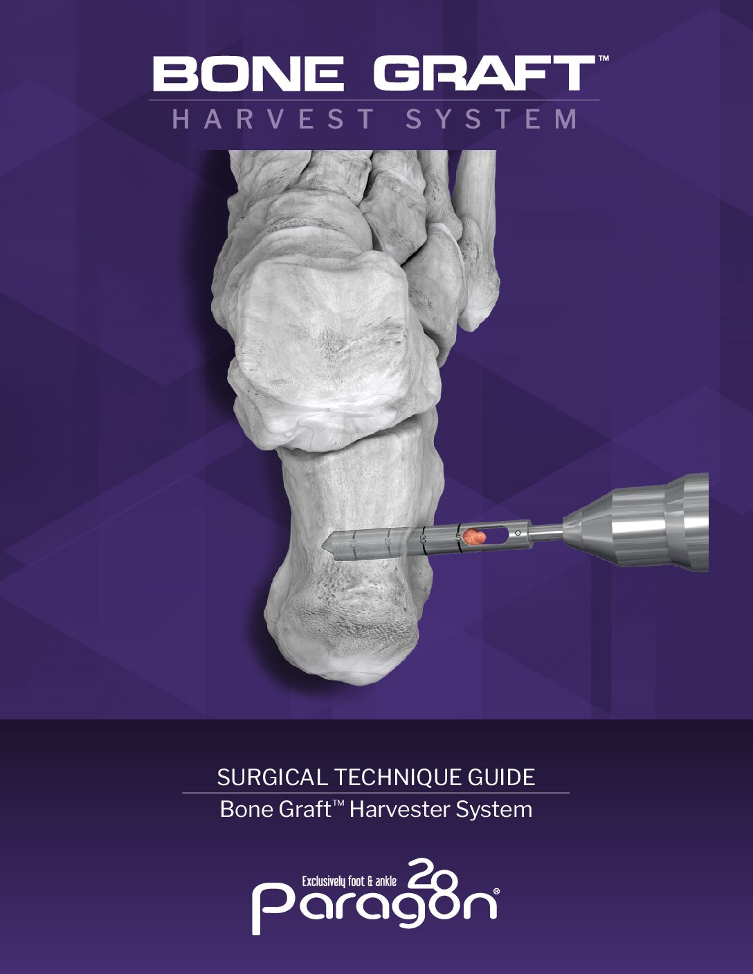 https://paragon.fru.qa/app/uploads/2025/11/P99-STG-0002-RevA-Bone-Graft-Harvester-STG-US-pdf.jpg