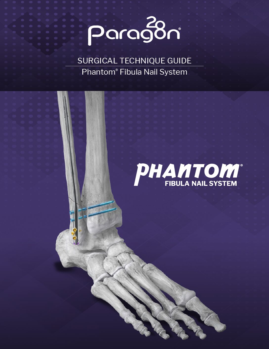 https://paragon.fru.qa/app/uploads/2025/12/P36-STG-2001-Rev.-A-Phantom-Fib-Nail-STG-Canada-pdf.jpg