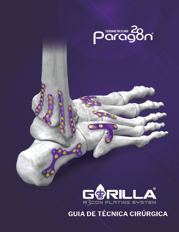https://paragon.fru.qa/app/uploads/2026/01/Gorilla-Plating-System-STG-BZL_Image.png