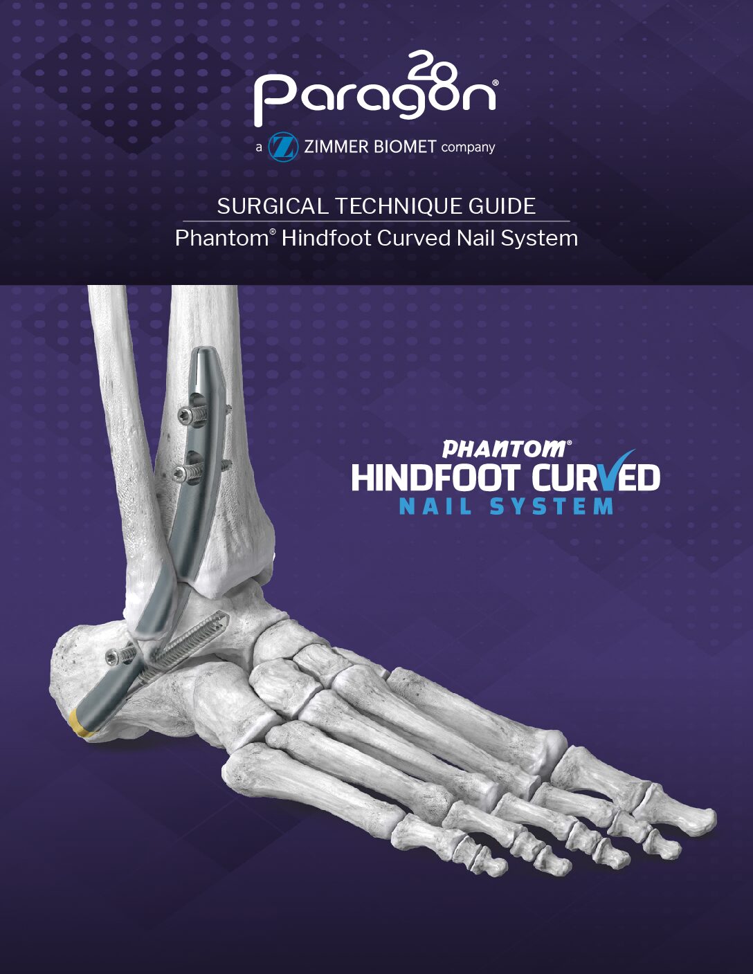 https://paragon.fru.qa/app/uploads/2026/01/P32-STG-0001-RevA_Phantom_Curved_Nail_STG-US-pdf.jpg