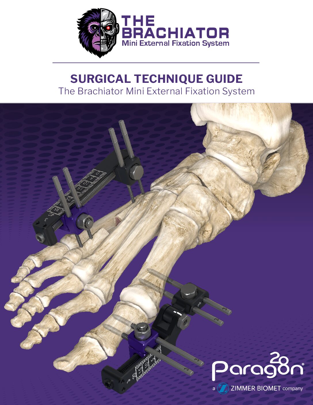 https://paragon.fru.qa/app/uploads/2026/02/P46-STG-0001_Brachiator_STG-RevB-US-pdf.jpg