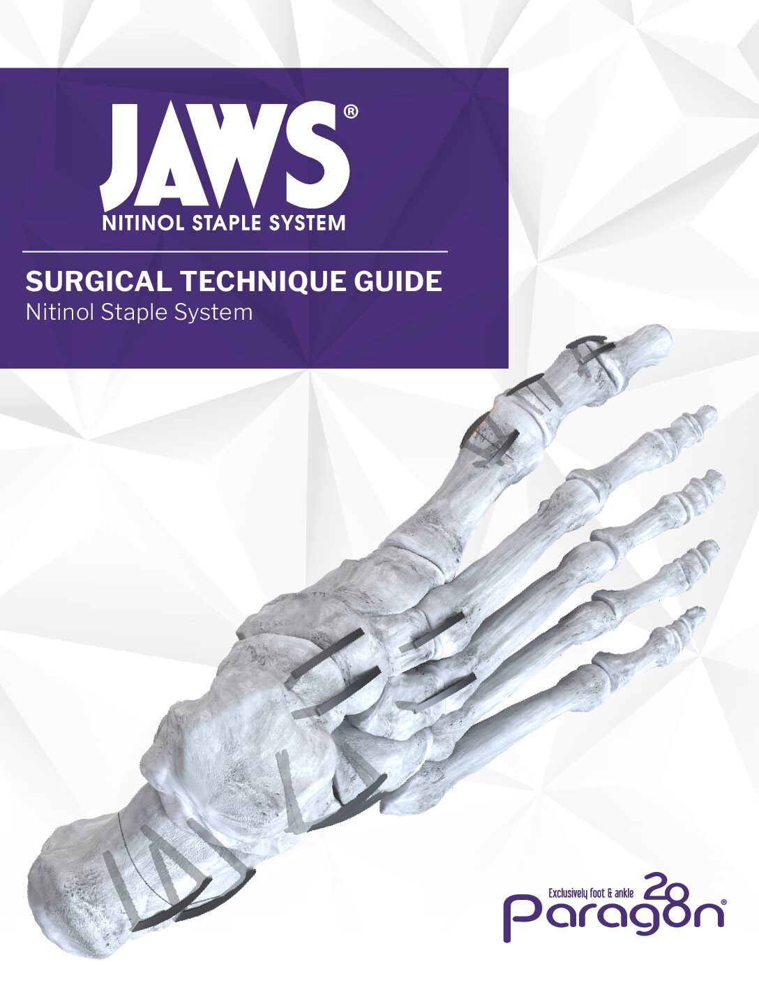 https://paragon.fru.qa/app/uploads/2026/02/P70-STG-1001_RevE_Jaws_Nitinol_Staple-CE-marked-pdf.jpg