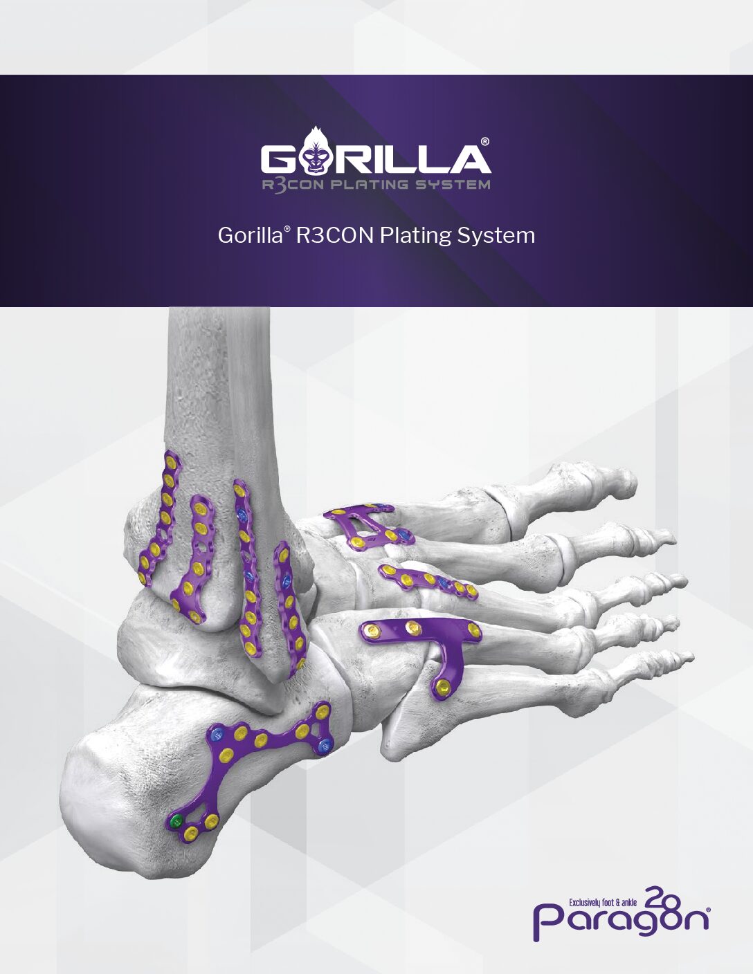 https://paragon.fru.qa/app/uploads/2026/03/GOBR-01-RevJ-Gorilla-R3CON-Plating-System-Brochure_Final-pdf.jpg