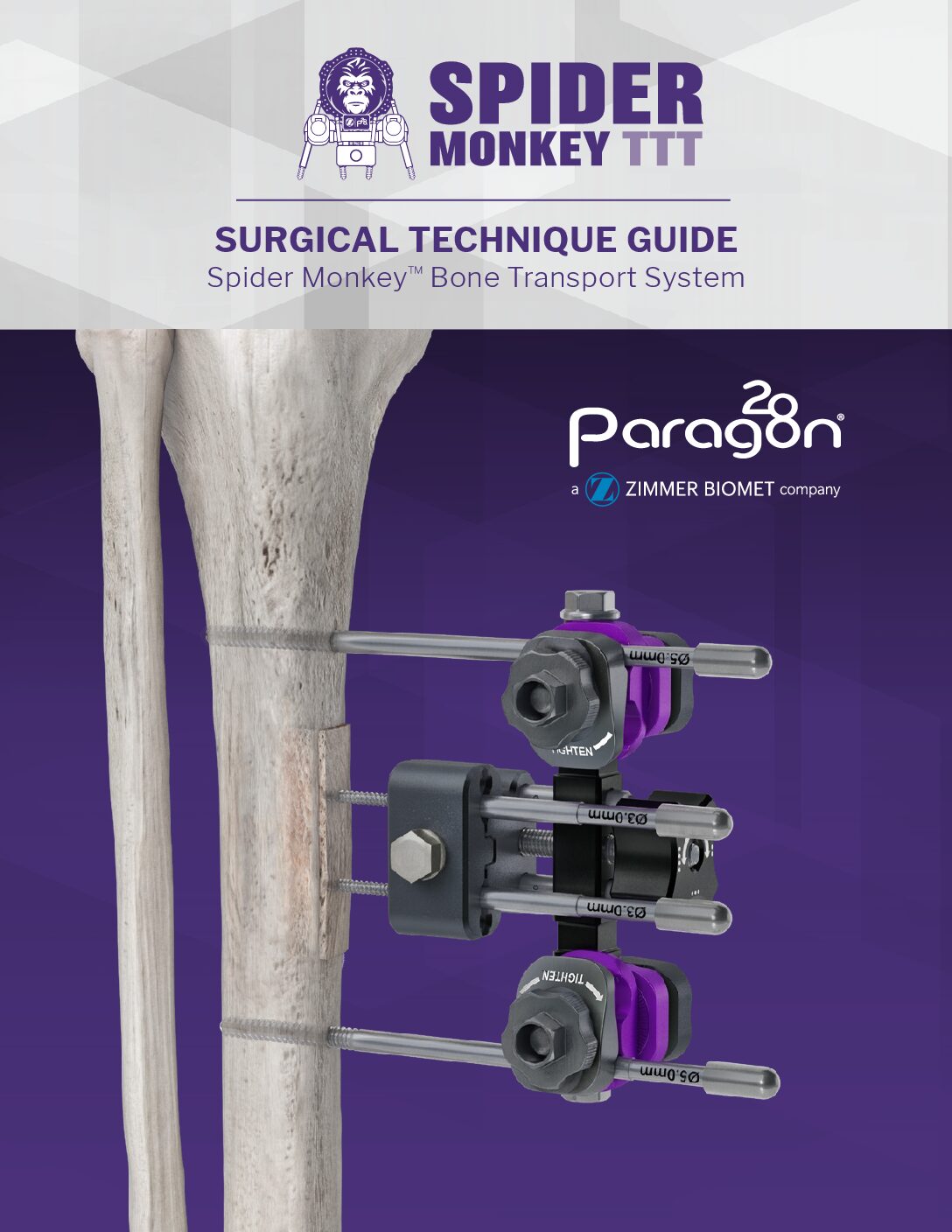 https://paragon.fru.qa/app/uploads/2026/06/P38-STG-0001_RevA_Spider_Monkey_BT-pdf.jpg